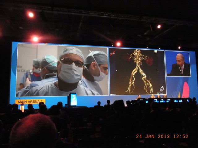 CICE — Congresso Internacional de Cirurgia Endovascular